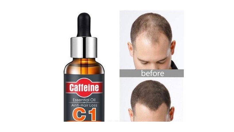 cul-pra-bndh-oo-ntun-gjay-caffeine-c1-anti-hair-loss-essential-oil-uk-big-0